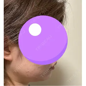 DMTC美容皮膚科 DMTC美容皮膚科 渋谷院口コミ