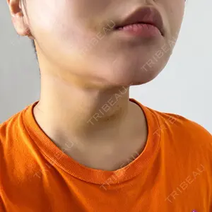 口コミ