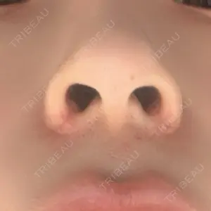 口コミ