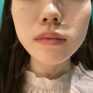HAAB×DREAM BEAUTY CLINIC HAAB×DREAM BEAUTY CLINIC 大阪梅田院口コミ