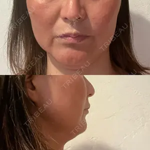 湘南美容クリニック 湘南美容クリニック 藤沢院口コミ