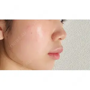 CZEN CLINIC 銀座院口コミ