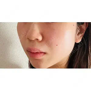 CZEN CLINIC 銀座院口コミ