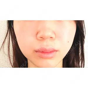 CZEN CLINIC 銀座院口コミ