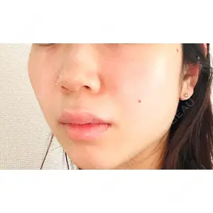 CZEN CLINIC 銀座院口コミ