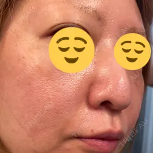 ゆきスキンクリニック 東池袋口コミ