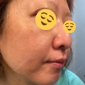 ゆきスキンクリニック 東池袋口コミ