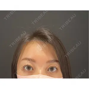 HAAB×DREAM BEAUTY CLINIC HAAB×DREAM BEAUTY CLINIC 大阪梅田院口コミ