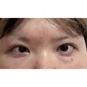 口コミ