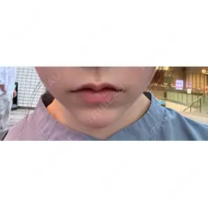 フィラークリニック フィラークリニック 名古屋栄院口コミ