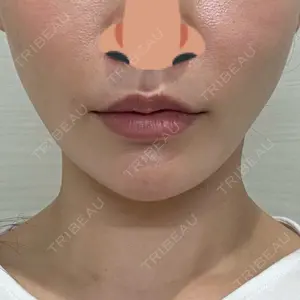 口コミ