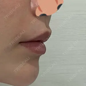 口コミ
