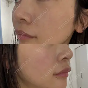 銀座TMクリニック口コミ