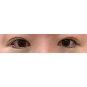 サラ美容外科口コミ