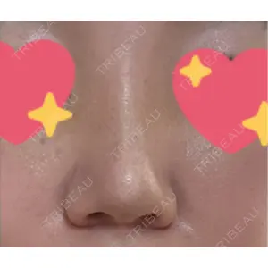 サラ美容外科口コミ
