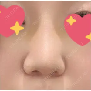 サラ美容外科口コミ