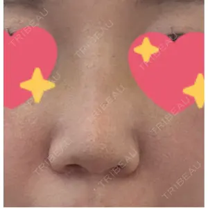 サラ美容外科口コミ
