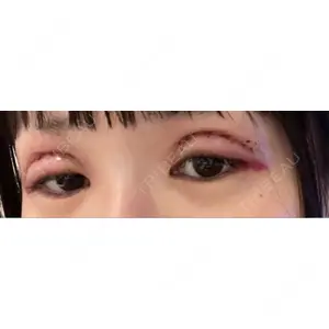 口コミ