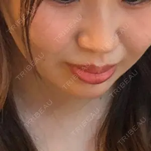 アリエル美容クリニック アリエル美容クリニック 大宮院口コミ