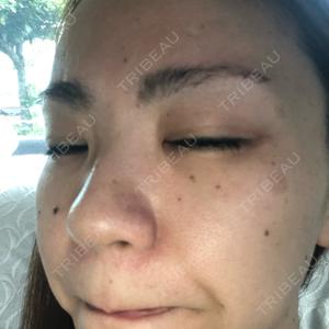 東京美容外科 東京美容外科 沖縄院口コミ