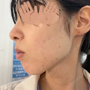 ルラ美容クリニック ルラ美容クリニック 上野院口コミ