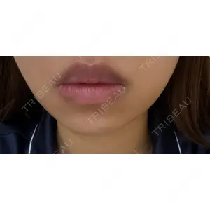 口コミ