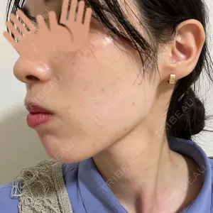 ルラ美容クリニック ルラ美容クリニック 上野院口コミ