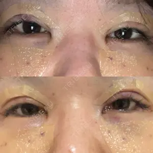 LUHO（ルホ）美容外科口コミ