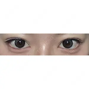 口コミ