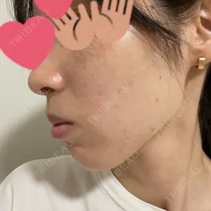 ルラ美容クリニック ルラ美容クリニック 上野院口コミ