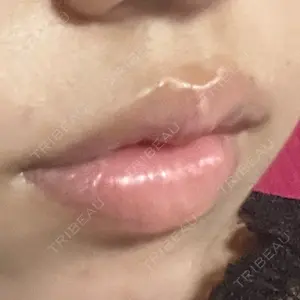 口コミ