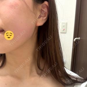 東京美容外科 東京美容外科 池袋院口コミ