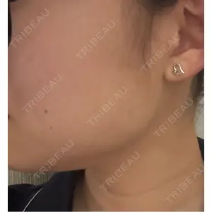 DMTC美容皮膚科 DMTC美容皮膚科 渋谷院口コミ
