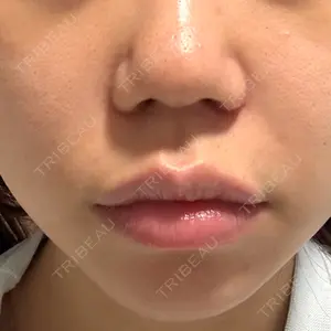 ルラ美容クリニック ルラ美容クリニック 池袋院口コミ