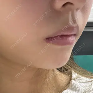 ルラ美容クリニック ルラ美容クリニック 大宮院 / ルラスキンクリニック 大宮院口コミ