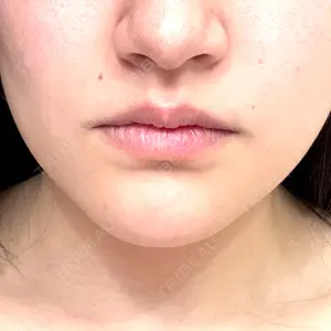 口コミ