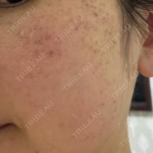 ルラ美容クリニック ルラ美容クリニック 広島院口コミ