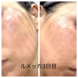 ルラ美容クリニック ルラ美容クリニック 広島院口コミ