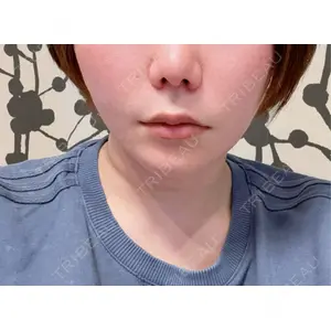 アリエル美容クリニック アリエル美容クリニック 大宮院口コミ