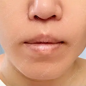 B-LINE CLINIC B-LINE CLINIC 池袋院口コミ