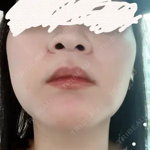 PRO CLINIC プロクリニック 銀座院口コミ