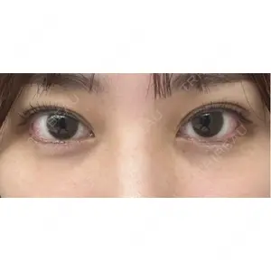 口コミ