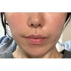口コミ