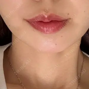 ルラ美容クリニック ルラ美容クリニック 名古屋栄院 / ルラスキンクリニック 名古屋栄院口コミ