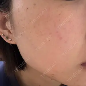 ルラ美容クリニック ルラ美容クリニック 池袋院口コミ