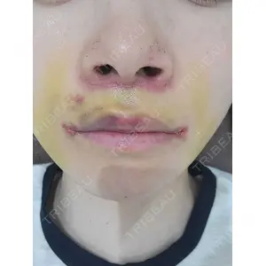 新宿ラクル美容外科クリニック 新宿ラクル美容外科クリニック 新宿院口コミ