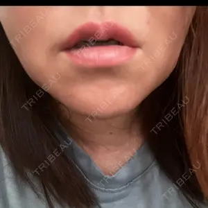 新未来クリニック口コミ