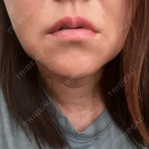 新未来クリニック口コミ