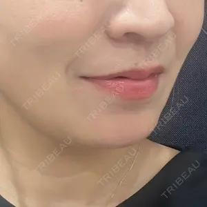 東京シンデレラ美容外科 東京シンデレラ美容外科 池袋院口コミ