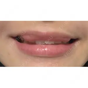 AZ BEAUTY CLINIC口コミ